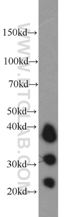 Cathepsin B Antibody in Western Blot (WB)