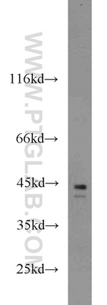 Cathepsin B Antibody in Western Blot (WB)