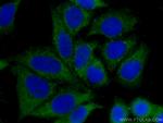PEPD Antibody in Immunocytochemistry (ICC/IF)