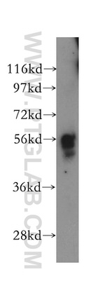 PEPD Antibody in Western Blot (WB)