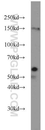 PEPD Antibody in Western Blot (WB)