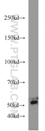 PEPD Antibody in Western Blot (WB)
