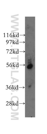 PEPD Antibody in Western Blot (WB)