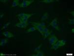 DYNC1I2 Antibody in Immunocytochemistry (ICC/IF)