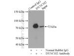DYNC1I2 Antibody in Immunoprecipitation (IP)
