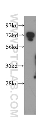 DYNC1I2 Antibody in Western Blot (WB)
