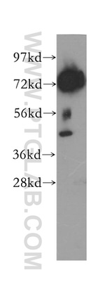 DYNC1I2 Antibody in Western Blot (WB)