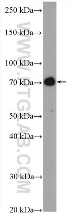 DYNC1I2 Antibody in Western Blot (WB)
