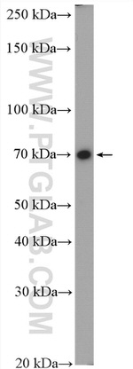 DYNC1I2 Antibody in Western Blot (WB)