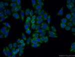 BMP7 Antibody in Immunocytochemistry (ICC/IF)