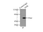 DAK Antibody in Immunoprecipitation (IP)