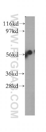 DAK Antibody in Western Blot (WB)