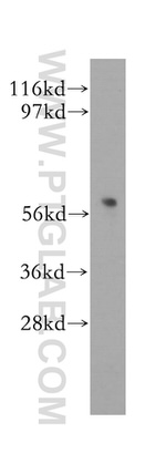 DAK Antibody in Western Blot (WB)