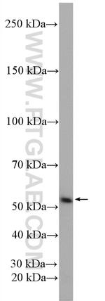 DAK Antibody in Western Blot (WB)