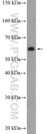 DAK Antibody in Western Blot (WB)