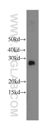 EIF4E2 Antibody in Western Blot (WB)