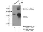 EIF4E2 Antibody in Immunoprecipitation (IP)