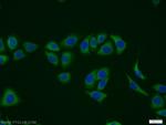 MVK Antibody in Immunocytochemistry (ICC/IF)