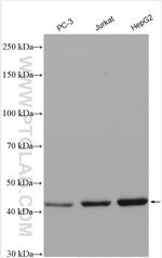MVK Antibody in Western Blot (WB)