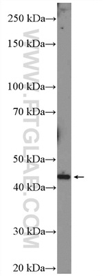 MVK Antibody in Western Blot (WB)