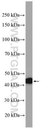 MVK Antibody in Western Blot (WB)