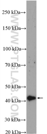 MVK Antibody in Western Blot (WB)