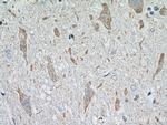 PRKACB Antibody in Immunohistochemistry (Paraffin) (IHC (P))