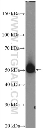 PRKACB Antibody in Western Blot (WB)