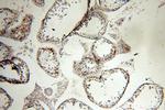 MAGEA1 Antibody in Immunohistochemistry (Paraffin) (IHC (P))
