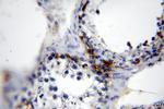 MAGEA1 Antibody in Immunohistochemistry (Paraffin) (IHC (P))