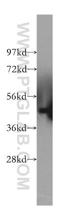 MAGEA1 Antibody in Western Blot (WB)