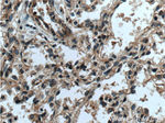 RAB38 Antibody in Immunohistochemistry (Paraffin) (IHC (P))