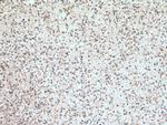 RAB38 Antibody in Immunohistochemistry (Paraffin) (IHC (P))
