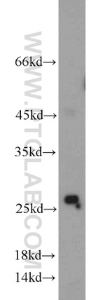 RAB38 Antibody in Western Blot (WB)