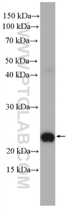 RAB38 Antibody in Western Blot (WB)