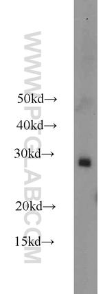 RAB38 Antibody in Western Blot (WB)
