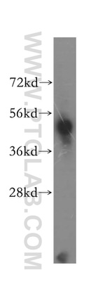 MKRN2 Antibody in Western Blot (WB)