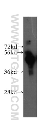 MKRN2 Antibody in Western Blot (WB)