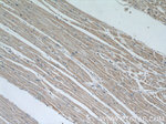 CBY1 Antibody in Immunohistochemistry (Paraffin) (IHC (P))