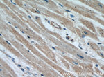 CBY1 Antibody in Immunohistochemistry (Paraffin) (IHC (P))