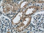 CBY1 Antibody in Immunohistochemistry (Paraffin) (IHC (P))