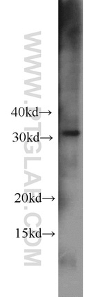 CBY1 Antibody in Western Blot (WB)