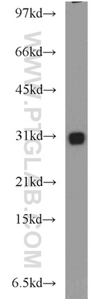 CBY1 Antibody in Western Blot (WB)