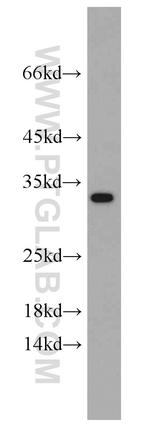 CBY1 Antibody in Western Blot (WB)