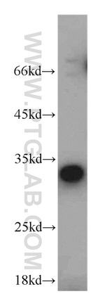 CBY1 Antibody in Western Blot (WB)