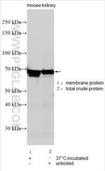 SLC12A8 Antibody in Western Blot (WB)