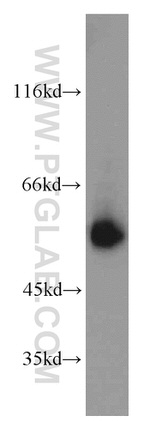 LCAT Antibody in Western Blot (WB)