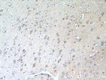 TAGLN3 Antibody in Immunohistochemistry (Paraffin) (IHC (P))