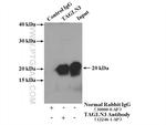 TAGLN3 Antibody in Immunoprecipitation (IP)