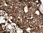 RCAS1 Antibody in Immunohistochemistry (Paraffin) (IHC (P))